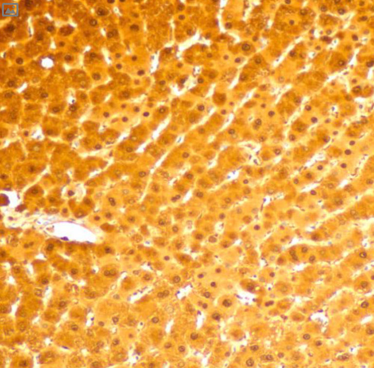 Arginase-1 Antibody - Pathologist Verified | MIBI Technology | Ionpath