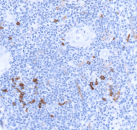 CD123 Antibody - Pathologist Verified | MIBI technology | Ionpath