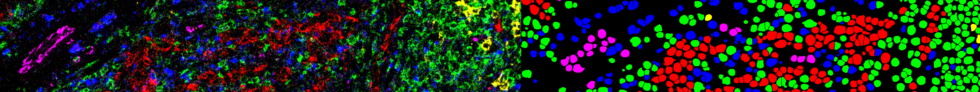 Ionpath | Highly Multiplexed IHC and MIBI Spatial Proteomics Analysis