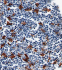 CD206-IHC-staining-FFPE-human-liver