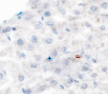 CD4-Ionpath-MIBI-staining-fresh-frozen-mouse-spleen