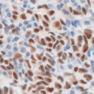 CD4-IHC-staining-fresh-frozen-mouse-spleen