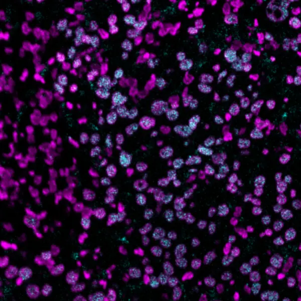 CD4-IHC-staining-fresh-frozen-mouse-spleen