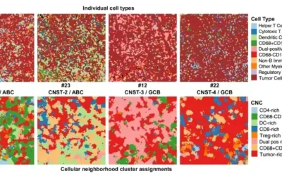 Uncovering Insights in Diffuse Large B-Cell Lymphoma with MIBIscope™